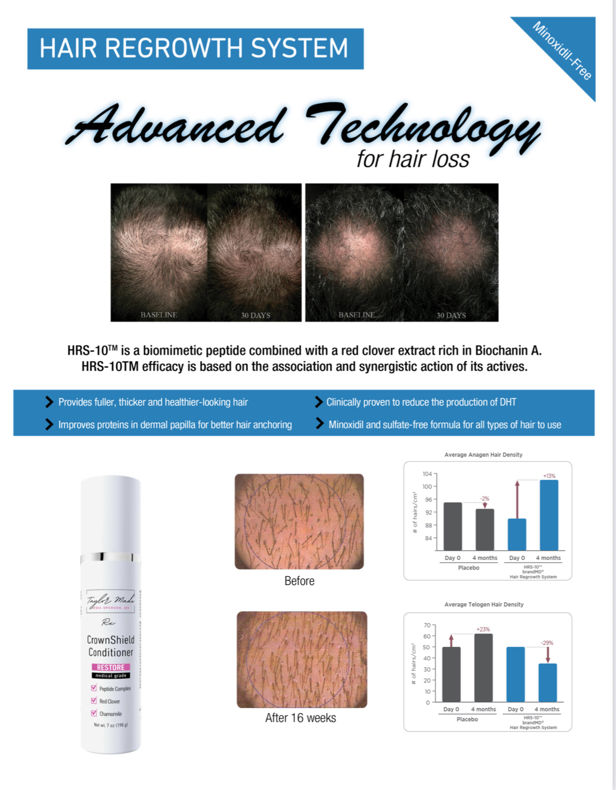 CrownShield Conditioner - Strengthening Hair Conditioner for Thinning Hair | Peptide & Botanical Formula | Oncology-Safe Hair Recovery System