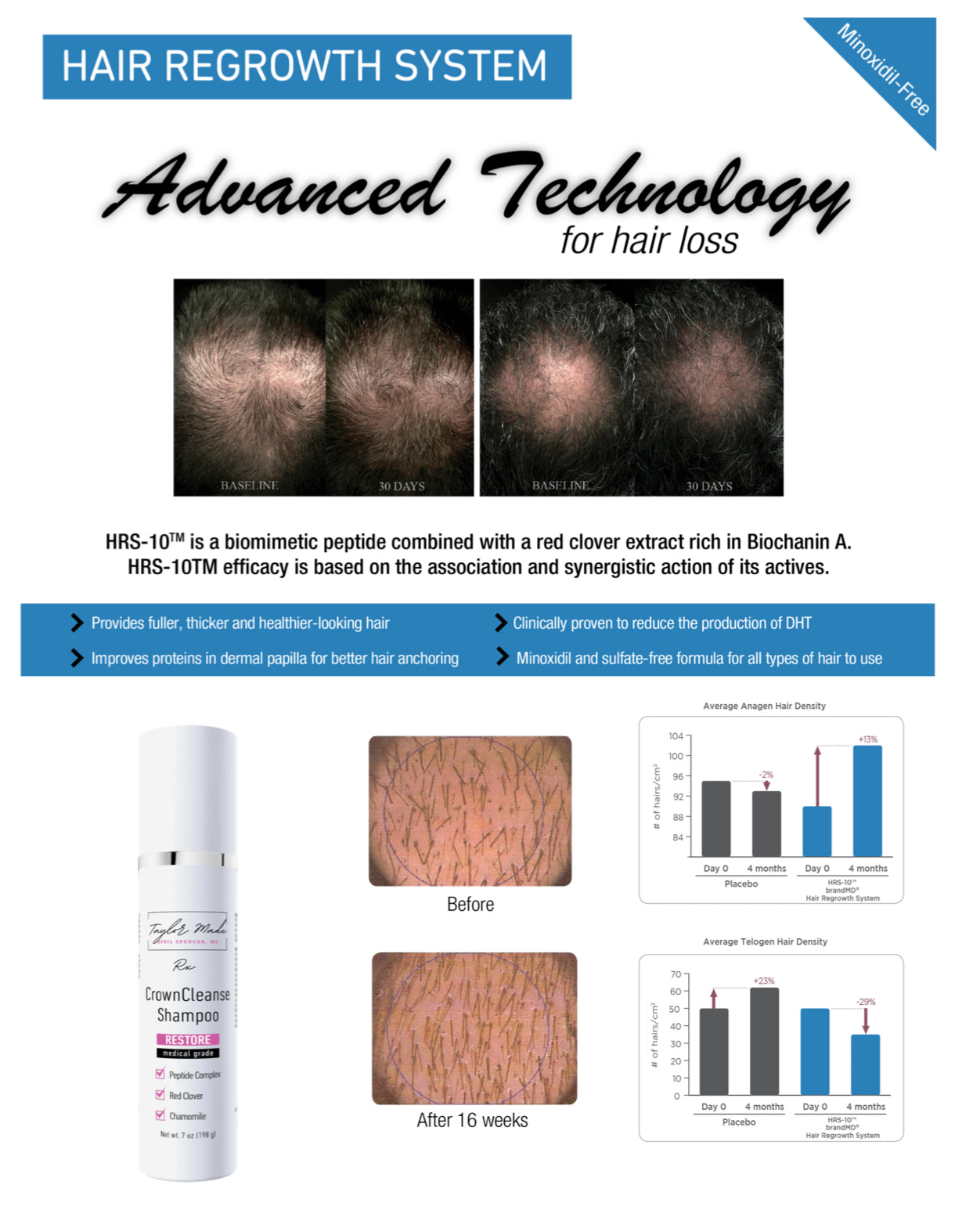 CrownCleanse Shampoo - Oncology-Safe Volumizing Cleanser | Sulfate-Free Formula for Thinning Hair | Breast Cancer Surgeon Formulated