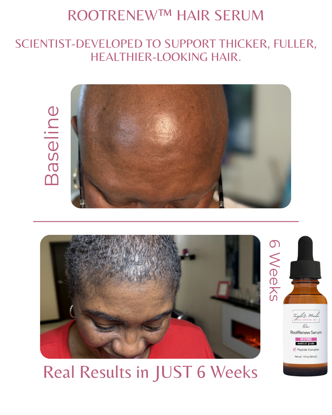 RootRenew™ Hair Renewal Serum | Advanced Scalp & Hair Support